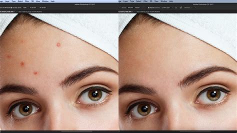 Five different and easy ways to clean up skin blemishes with Photoshop