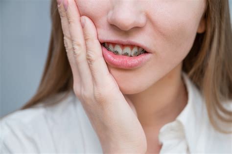 Braces Pain Relief - You Might Be Wanna Help Your Kid With Pain ...