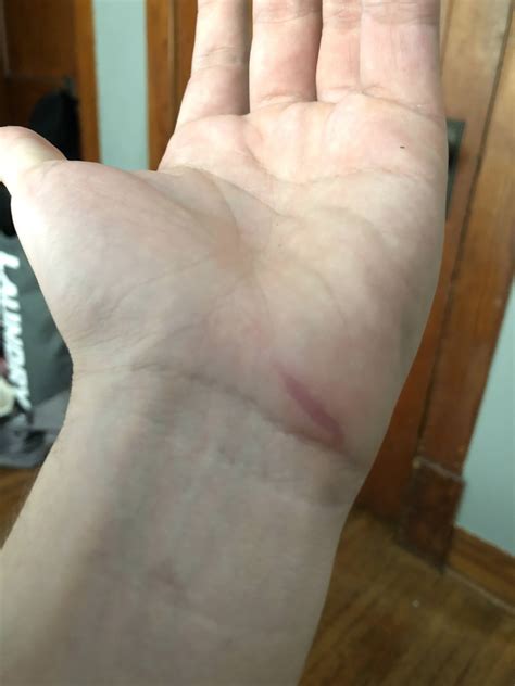 When a glass breaks in your hand for no reason : bartenders