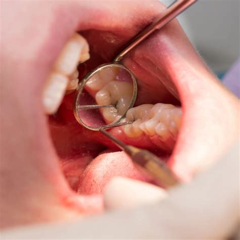 Znáte nejznámější mýty o zubní hygieně? | OROXID.CZ