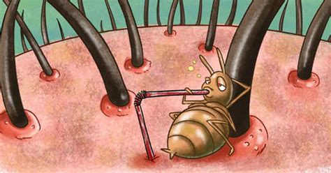 O Que É Pediculose - O que é Pediculose (Piolho), Tratamento, Remédios e Sintomas | Saúde ...