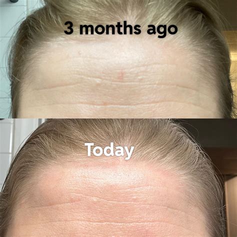 Beauty bloggers explain the best makeup tricks for large forehead celebrities 32