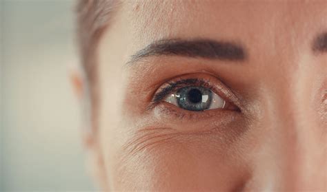 essential anti aging treatments   eye wrinkles lala daisy