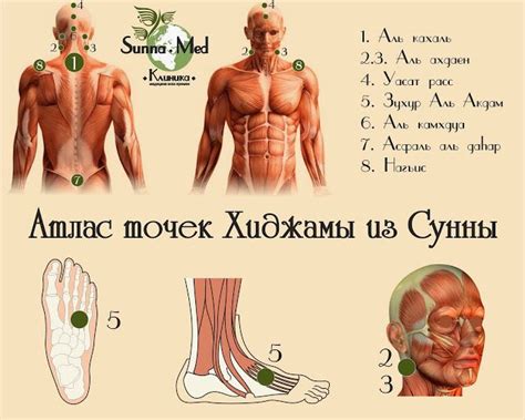 Все про ХИДЖАМУ (кровопускание) | Кровопускание, Точки, Блог