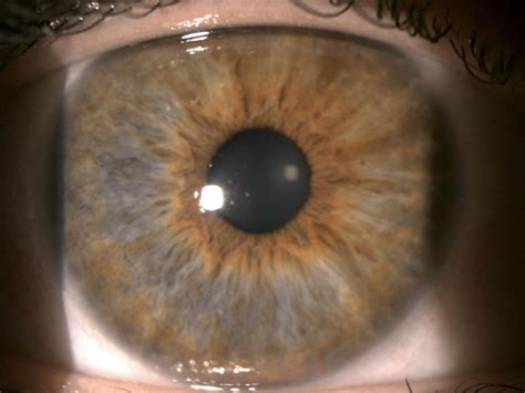 Scott Eye Care | Scott LA