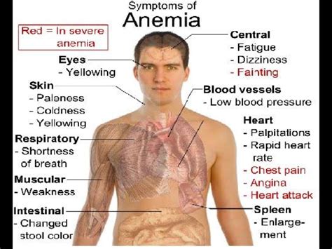 What Is The Anemia Blood Pressure at Hudson Lucilla blog