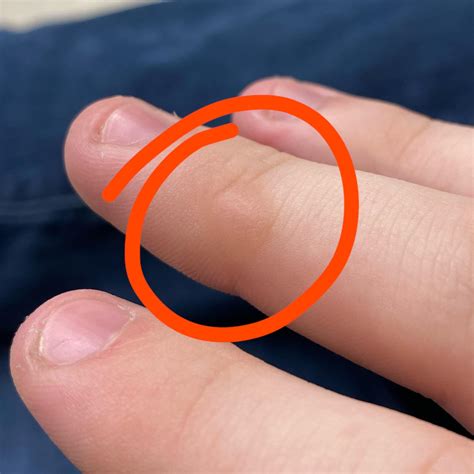 Anyone else got a writer’s callus on their right middle finger? : r