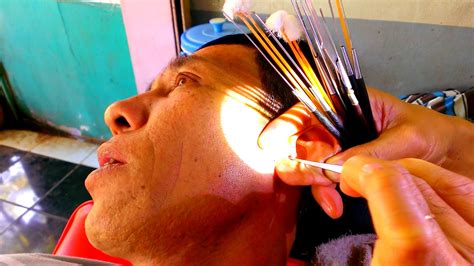 massive earwax removal  happy sai gon street food  travel youtube