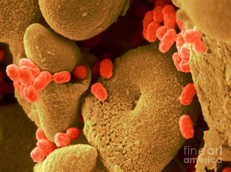 serratia marcescens photograph  scimat fine art america