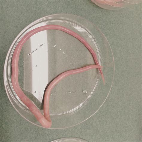 Ascaris Suum Askariasis | SpringerLink