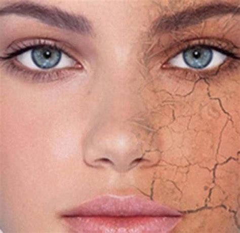 dull skin bay aesthetics clinic  medispa