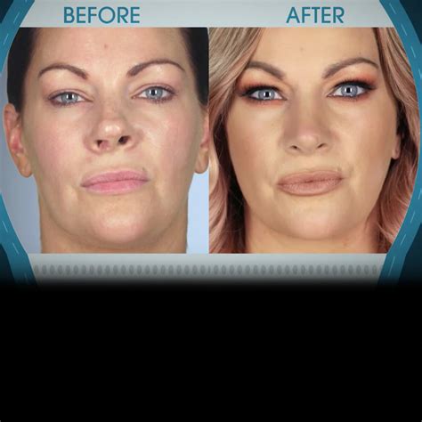 Imagefap Celebrities: Their Most Shocking Transformations - jpad4i5
