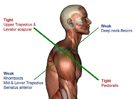 deep neck flexors anatomy  ultimate neck training exercises