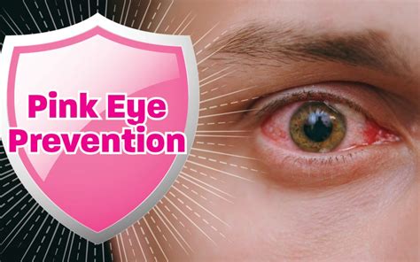 Tips for Pink Eye Prevention | The answers to your pink eye questions!