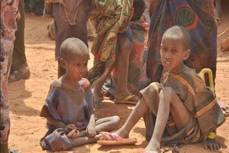 Crianças Passando Fome Na áfrica - 9