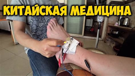 ИГЛОУКАЛЫВАНИЕ 💉 В КИТАЕ. НЕТРАДИЦИОННАЯ КИТАЙСКАЯ МЕДИЦИНА. ВИКТОР ...