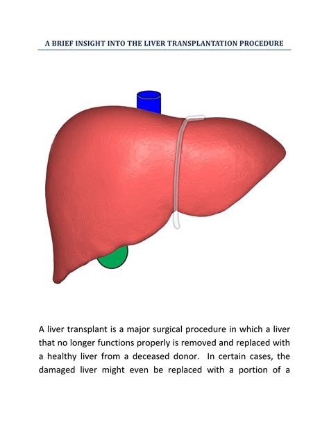 how long does it take to get a liver transplant