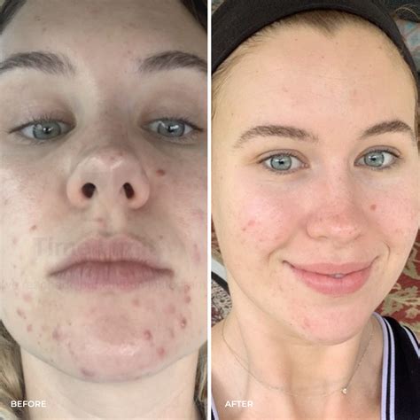 Heal All Oil – THE GOLDEN SECRETS