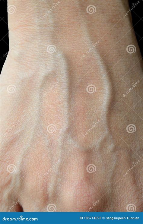 Blood Veins on Black Background Stock Image - Image of care, blood: 185714023