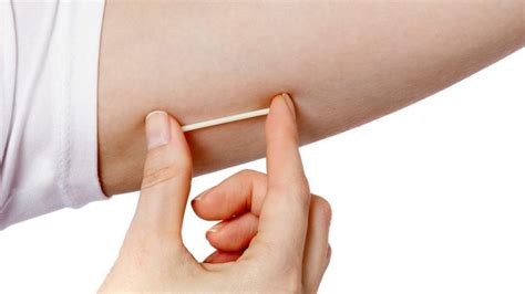 contraceptive implant