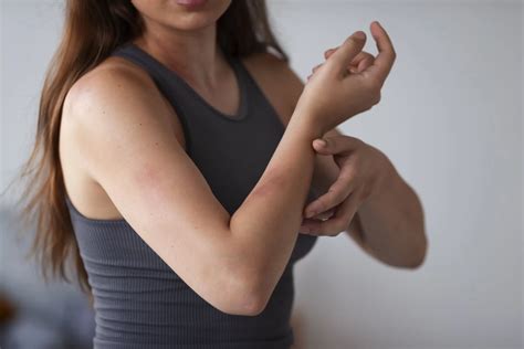 Skin rash: causes, symptoms, and treatments - ANNVIO
