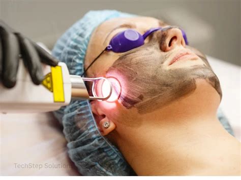 laser dark spot removal  irvine lake forest ca