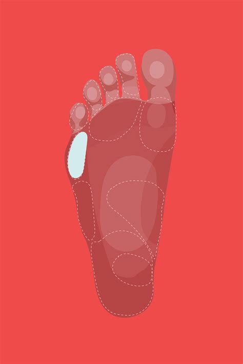 Foot Pain By Toes at Orville Elva blog
