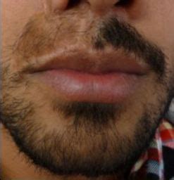 how to stimulate facial hair growth