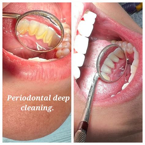 Liberty Dental Clinic | Tijuana