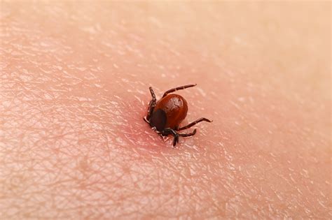 How Do Humans Get Ticks
