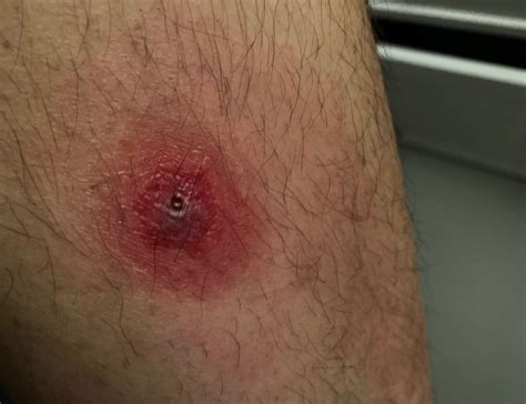 brown recluse spider loxosceles reclusa glenlivet wildlife