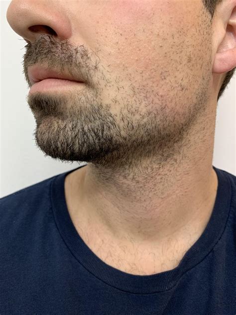 properly shape  disconnected goatee goatee beard rules