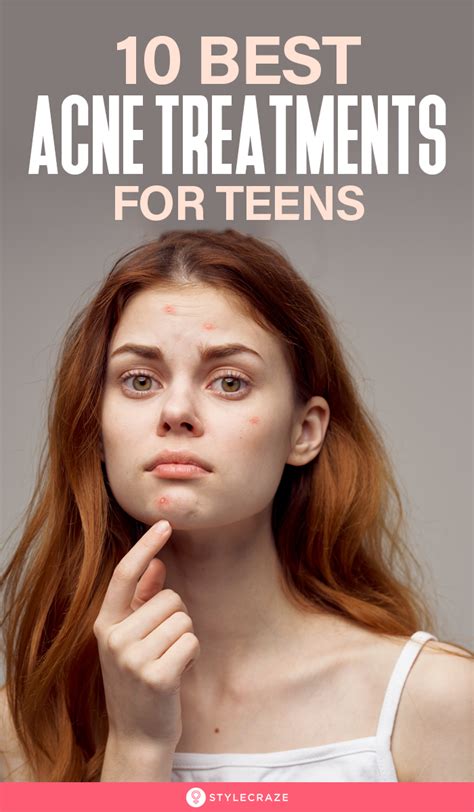 10 best acne treatments for teens that can help prevent breakouts – Artofit