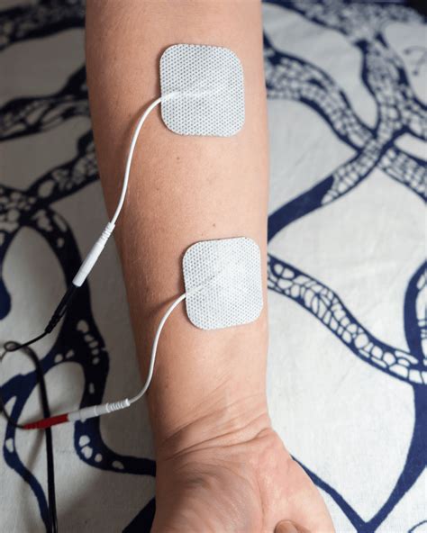 iontophoresis therapy central texas physical therapy