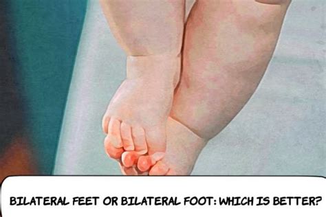 Bilateral Feet or Bilateral Foot: Which Is Better? — Responsefully