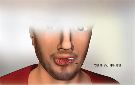 health condition symptoms  treatment