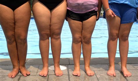 But You Have Such a Pretty Face! 18 Backhanded Fat-Shames, and Their