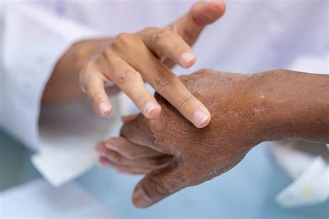 Societies - Dermatology Foundation