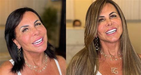 Idade De Gretchen 2025 - Gretchen faz antes e depois de novo visual e fãs elogiam