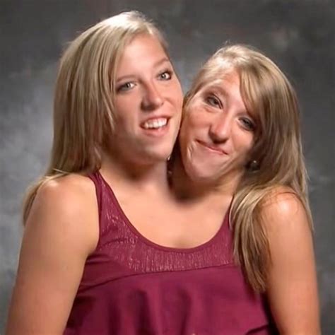 conjoined twins abby  brittany hensel reveal surprising details