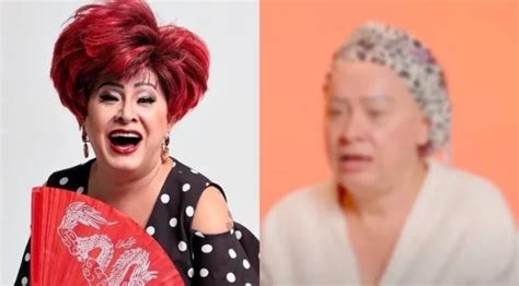 Cirurgia Nany People Antes E Depois