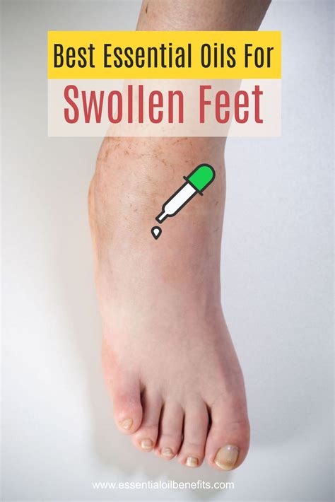 Essential oils for swollen feet when your feet are more bloated than a
