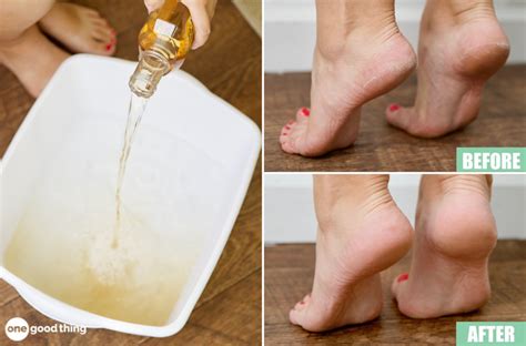 How To Make A Vinegar Foot Soak: Tips, Benefits, And Risks ...