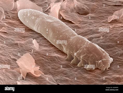 Eyelash mite. Coloured scanning electron micrograph (SEM) of an eyelash ...