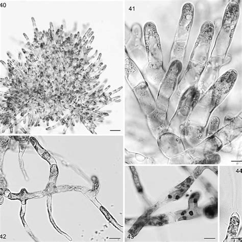 (PDF) Revision of the genus Ulvella (Ulvellaceae, Ulvophyceae) based on ...