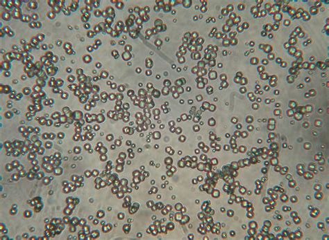 Nitroprusiato; Nitroferricianida; Nitroprusiato de Sodio
