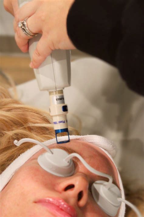 Laser Treatments - Proper Eu Medical & Aesthetics Center