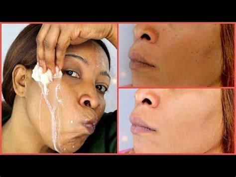 How To Brighten Skin Naturally Fast - Resipes my Familly