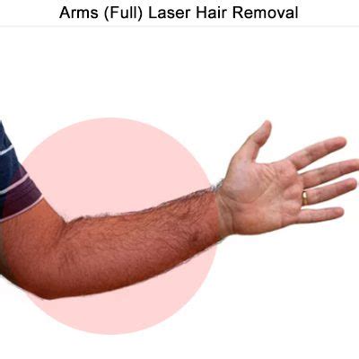 Arms (Full) Laser Hair Removal - Electrolysis Toronto