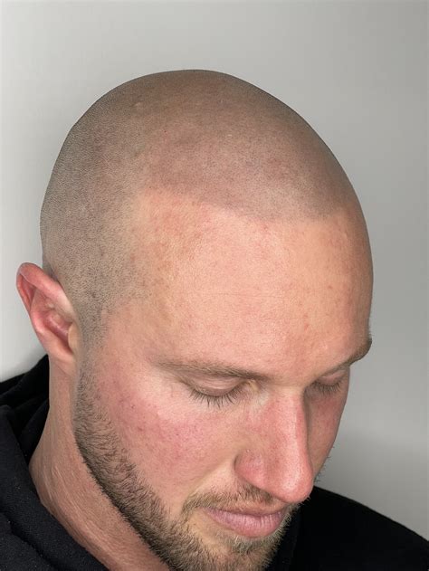 Scalp tattoos will soon be paired with men buzz cut hairstyles 23